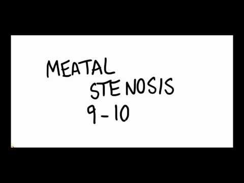MEATAL STENOSIS Practice Video 1