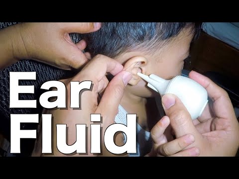 Cleaning Little Boy's Infected Ear Using A Bulb Syringe | It's A Glue Ear!