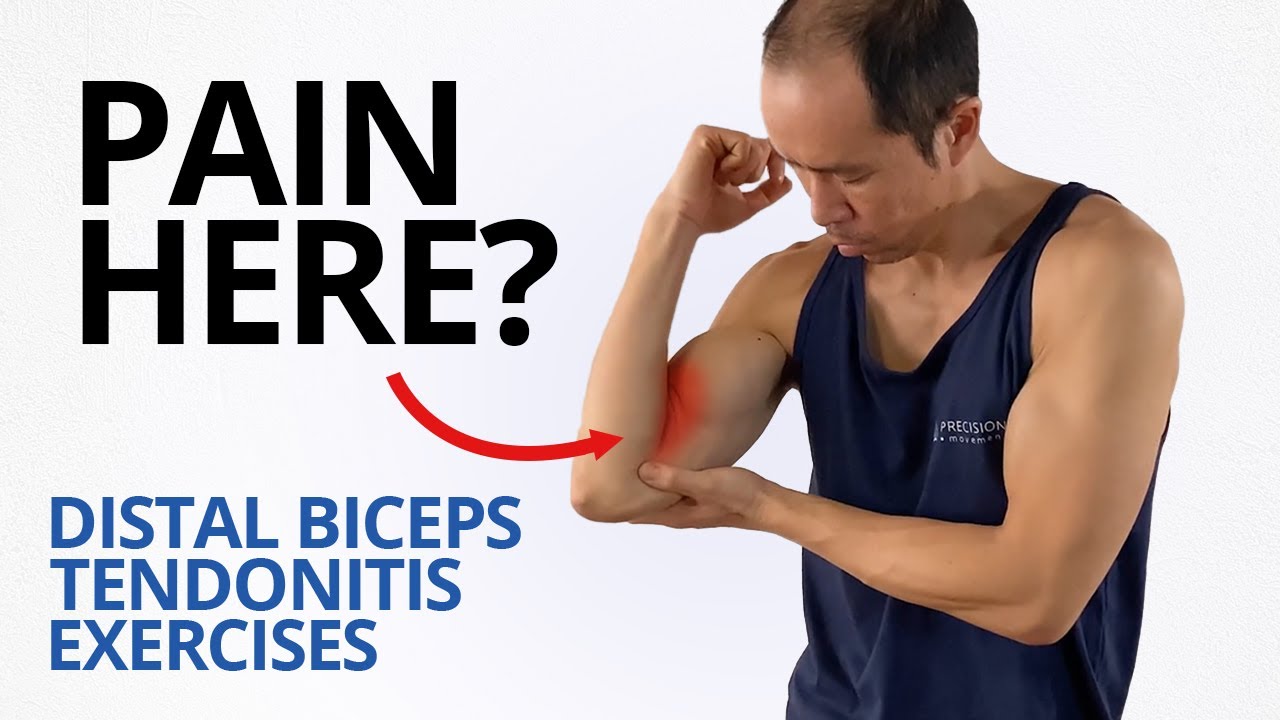 Exercises To Relieve Bicep Tendonitis | lupon.gov.ph