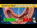 Cholesterol Explained: Good vs Bad | Heart Health Facts #cholesterol