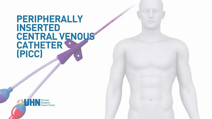 Learn About the Peripherally Inserted Central Venous Catheter (PICC)