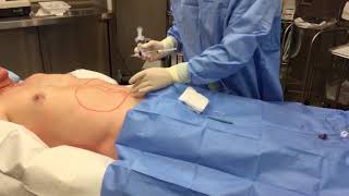 ManShot Priapus Shot RM Tx for Peyronie's Disease | Hogue Clinics