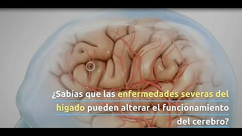 ¿Cómo afecta el amoníaco al cerebro?