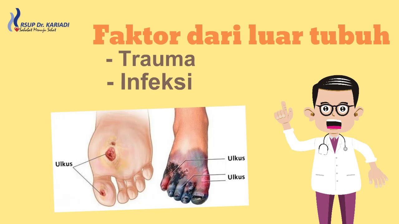 diabetes penanganan ulkus diabetes penanganan ulkus