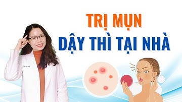 Trị mụn dậy thì tại nhà cần biết 6 điều này - Bác sĩ Nguyên