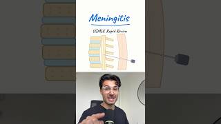 Meningitis on the USMLE π§ π¦ #usmle #usmlestep1 #neurology #usmlestep2 #medstudent