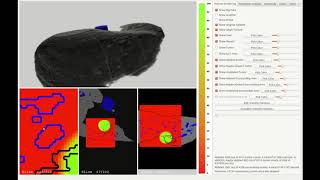 Uncertainty-aware visual analysis of radiofrequency ablation simulations