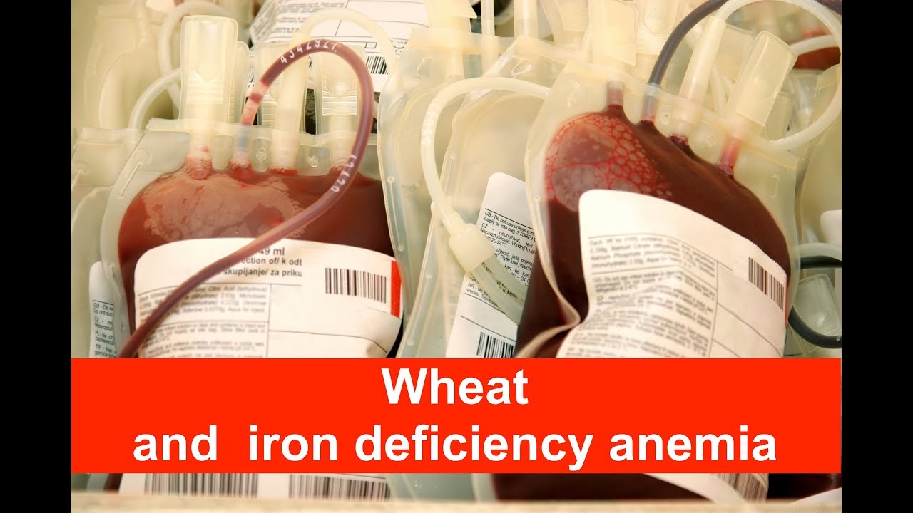 Wheat and iron deficiency anemia YouTube