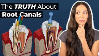 What to Expect During a Root Canal Procedure