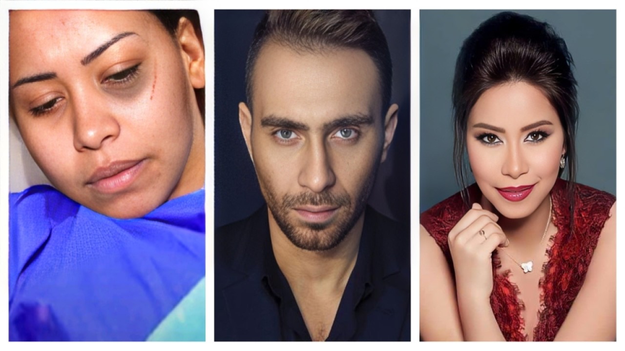 شيرين عبد الوهاب بتموت.. رد فعل حسام حبيب بعد نفل الفنانة للمستشفى ودخولها عناية مركزة ف حالة خطيرة