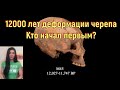 12000 лет деформации черепа. Кто начал первым? [№ R-055.04.06.2021.]