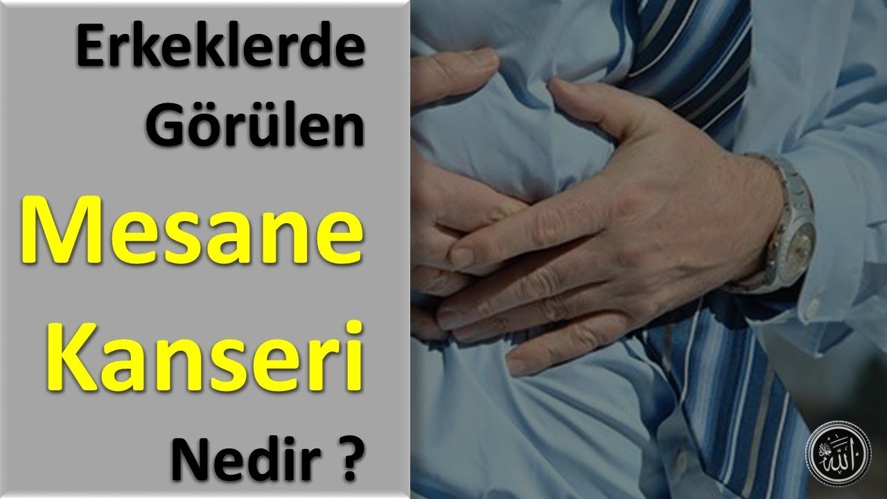 Erkeklerde Görülen Mesane Kanseri Nedir YouTube Erkeklerde Görülen Mesane Kanseri Nedir YouTube