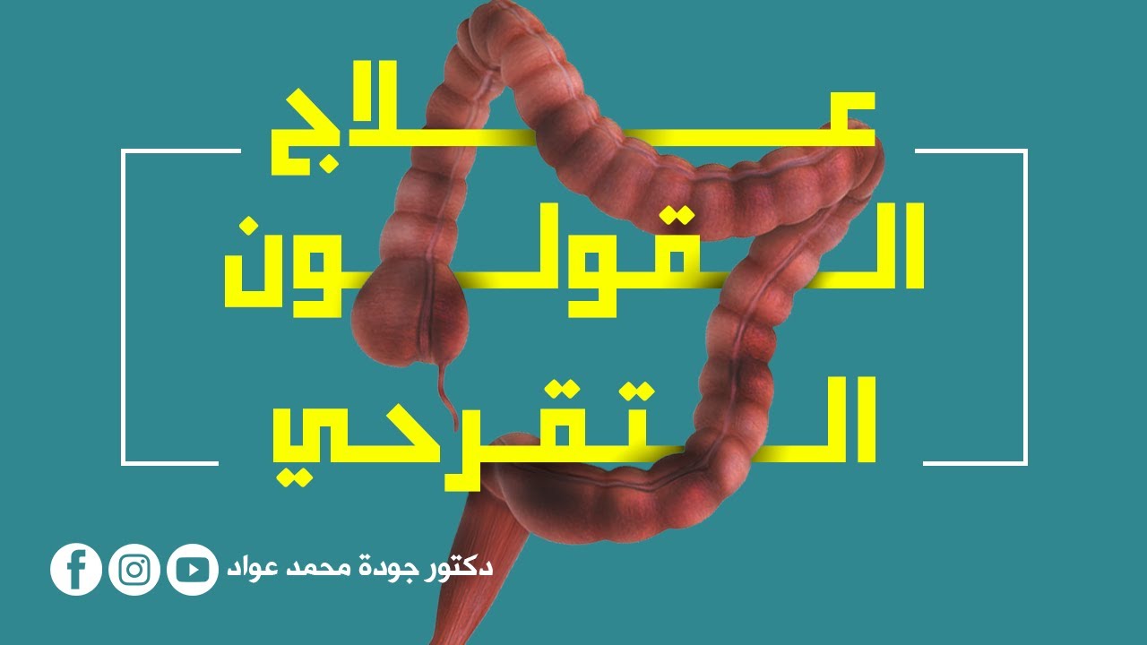 ازاي ده قولون؟!! | علاج القولون التقرحي