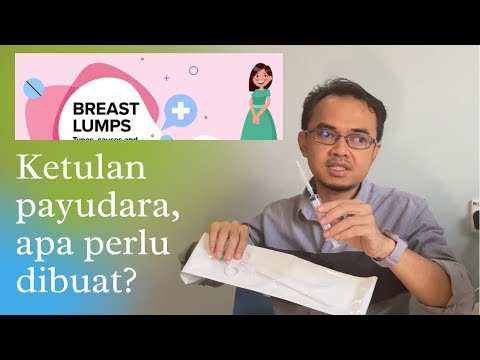 ketulan payudara (apa perlu buat?)