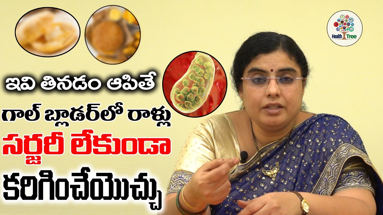 The Gall Bladder Stone Symptoms And Treatment || పిత్తాశయంలో రాళ్ళు | Health tree #Gallbladderstones