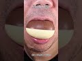 Satisfying Chewing ASMR #Compilation #ASMR #DoctorTristanPeh