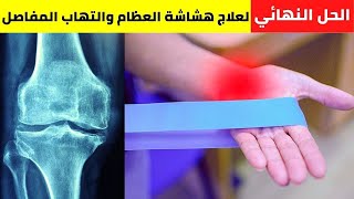 الحل النهائي لعلاج هشاشة العظام والتهاب المفاصل بشكل فعال | علاج تأكل الغضاريف | osteoporosis