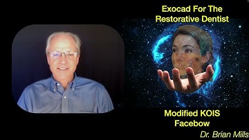 Estimated Hinge Axis Using a KOIS facebow