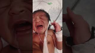 Hungry Baby NG Tube Removal Procedure #HungryBaby #NGTubeRemoval #BabyCare #NICU #NewbornCare