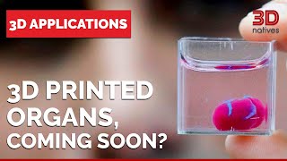 : How soon are 3D printed organs coming?