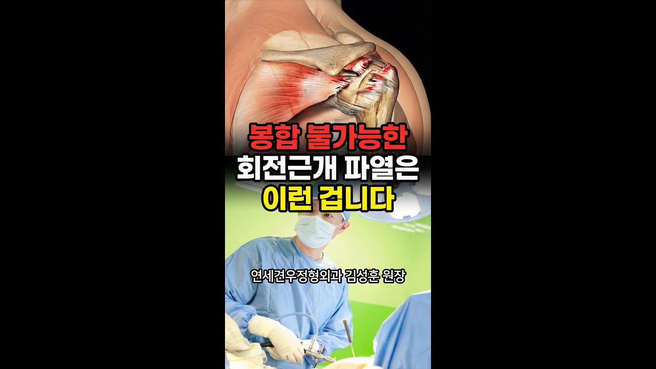 봉합불가능한 회전근개 파열 - YouTube