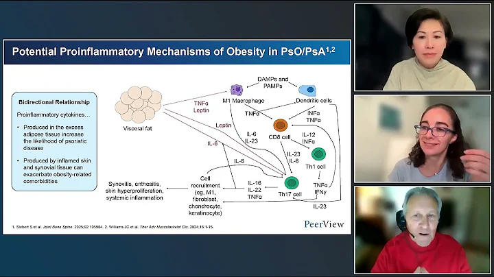 Tackling Obesity in Psoriatic Arthritis