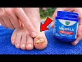 Expensive Nail Treatments Try This Instead