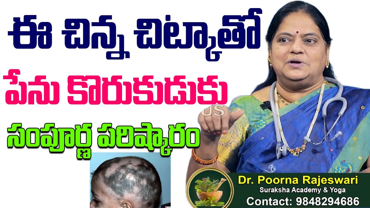 Alopecia Natural Treatment :ఈ చిన్న చిట్కాతో పేను కొరుకుడుకు సంపూర్ణ పరిష్కారం |Dr. Poorna Rajeswari