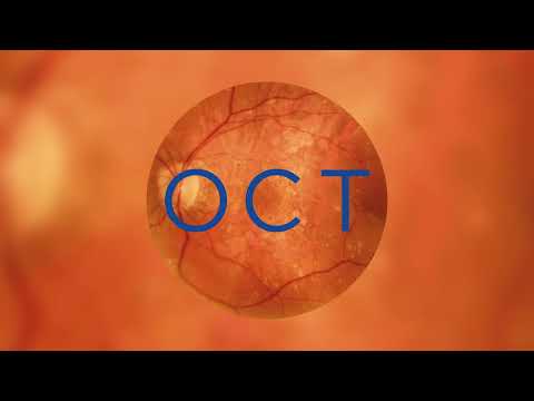 Scopri Optovue Solix di Visionix - video from Optovue