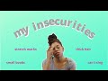 MY INSECURITIES