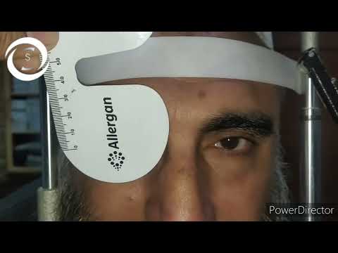 Diplopia ka elaaj(Urdu/Hindi)