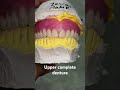 Upper complete denture 😬😬😬#splittooth #apexdental #dentistry #partialdenture #orthodontist