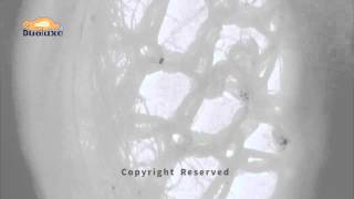 Dust Mites Experiment