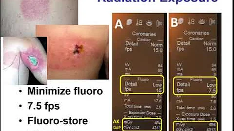 Starting a CTO PCI program