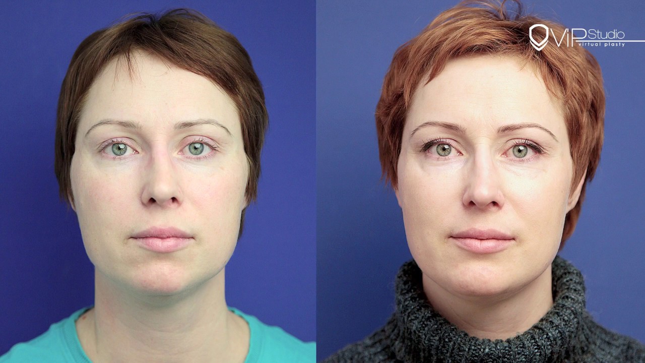 Ментопластика от Гурьянова А.С.