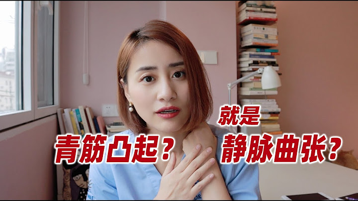 误区？！青筋凸起就是静脉曲张吗？是否需要治疗？by 朱筱吟医生 - 天天要闻