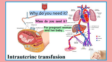 intrauterine transfusion
