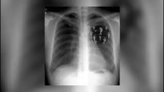 Epiphany - BTS JIN (sped up)