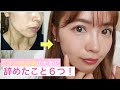 【大人ニキビ】繰り返すニキビの為に辞めた事!6つ!