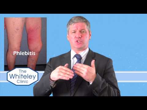 Video: Flebitis - Flebitis Efter Injektion