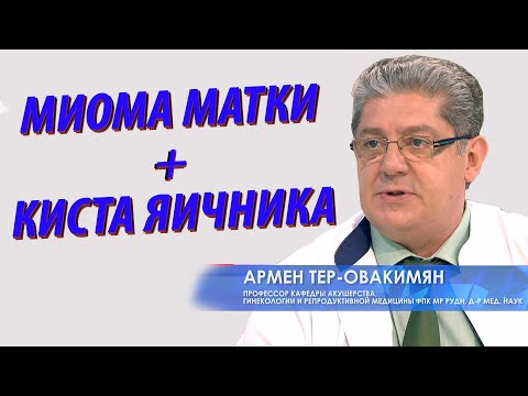 Миома матки + киста яичника. Сочетанные операции в гинекологии