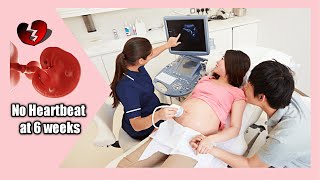 When A 6-Week Scan Show No Heartbeat What Next?