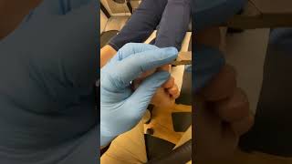 Get Ready For A Wow Moment! Watch An Aussie Podiatrist Master Long Nail Trimming!