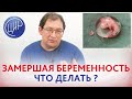 Замершая беременность на 6 неделе. Что делать после замершей беременности. Отвечает Гузов И.И.