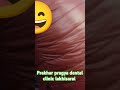 “Painless Tooth Extraction for Kids ✨”#dentist #viralvideo #trending