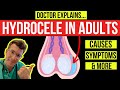 What is a hydrocele doctor explains causes symptoms and treatment including surgery
