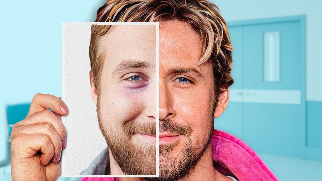 Is Ryan Gosling’s Face All Natural? | Plastic Surgery Analysis