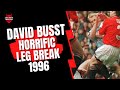 David Busst Horrific Leg Break 1996