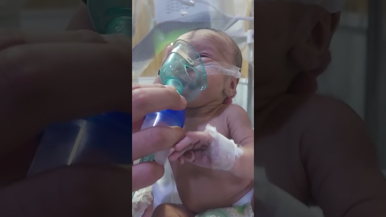  *"Neonatal Baby Struggling to Breathe 😢 | Heart-Touching NICU Moment"*  