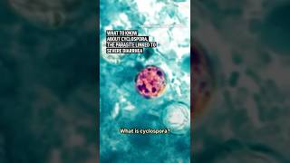 What to know about cyclospora, the parasite linked to severe diarrhea